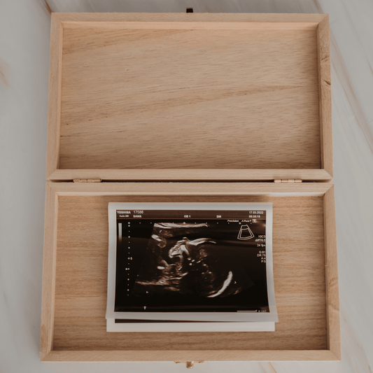 Houten bewaardoosje voor echofoto’s, perfect om dierbare herinneringen veilig te bewaren. Dit doosje is ideaal om je eerste echo’s op een mooie en georganiseerde manier te bewaren - Doosje en echofoto's in het doosje.